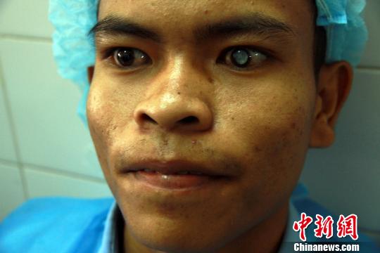 20岁的先天性白内障患者伦占塔满怀希望等待中国医生为他手术，之后他的手术很成功。　关向东 摄